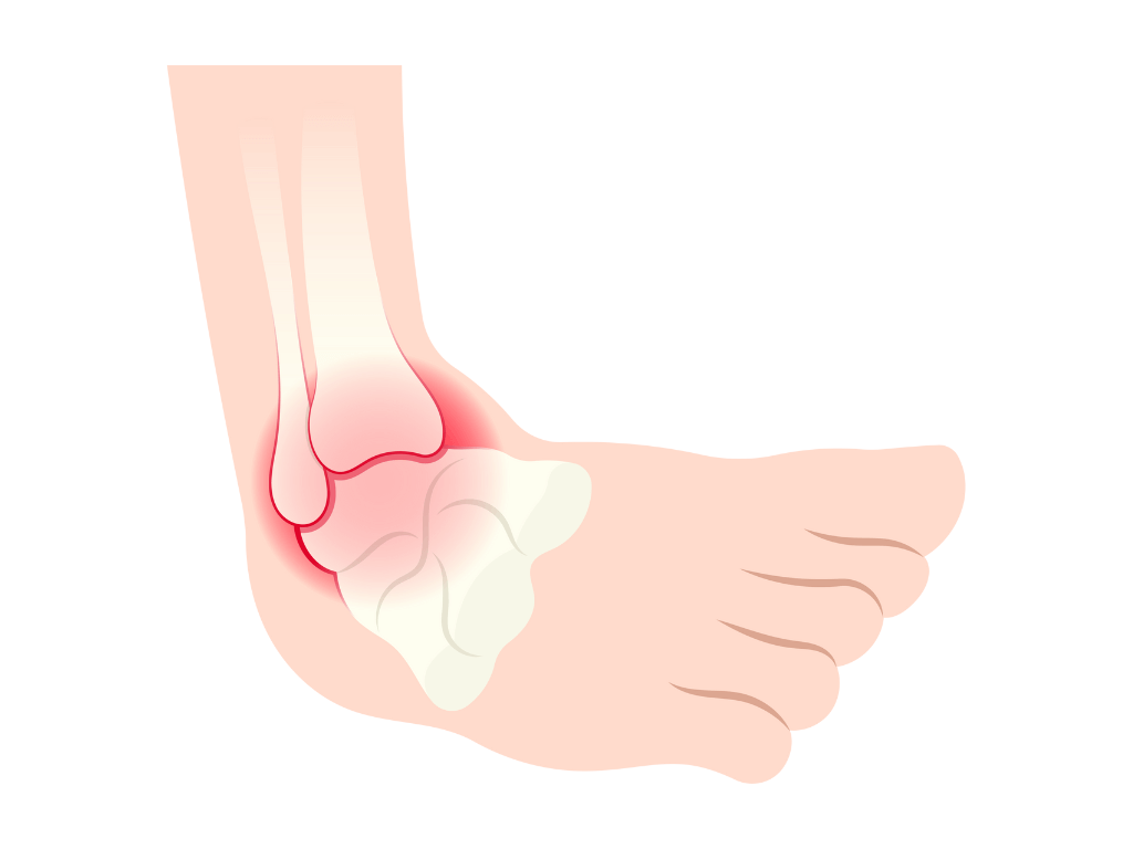 stabilni-kotniky2